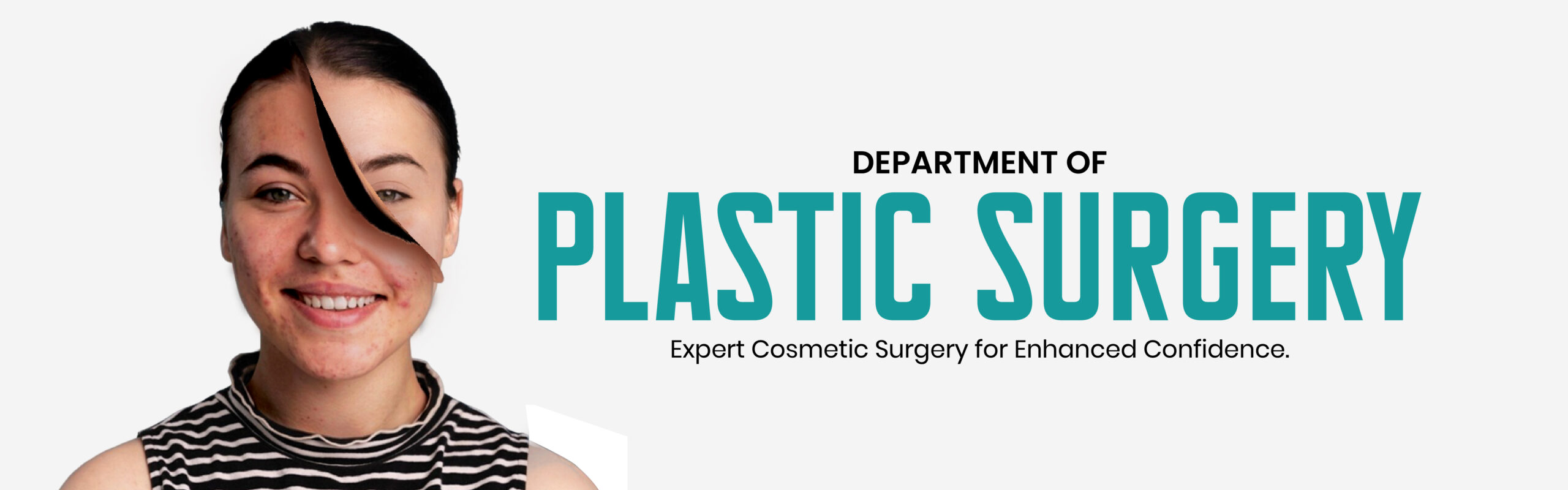 plastic surgery